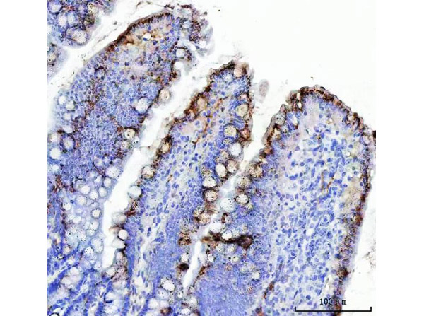 Immunohistochemistry analysis of Mucin Gastric